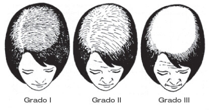 Scala di Ludwig